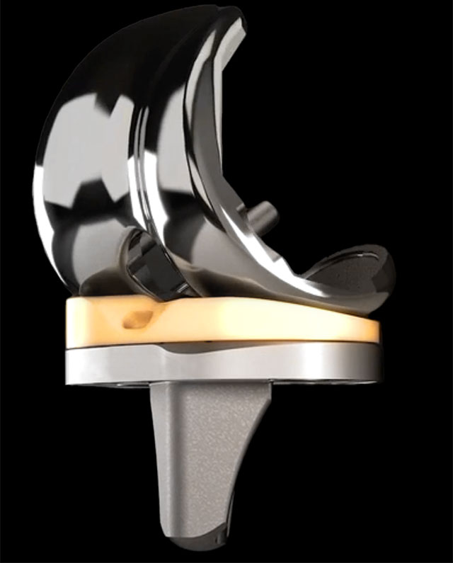 Enovis Surgical