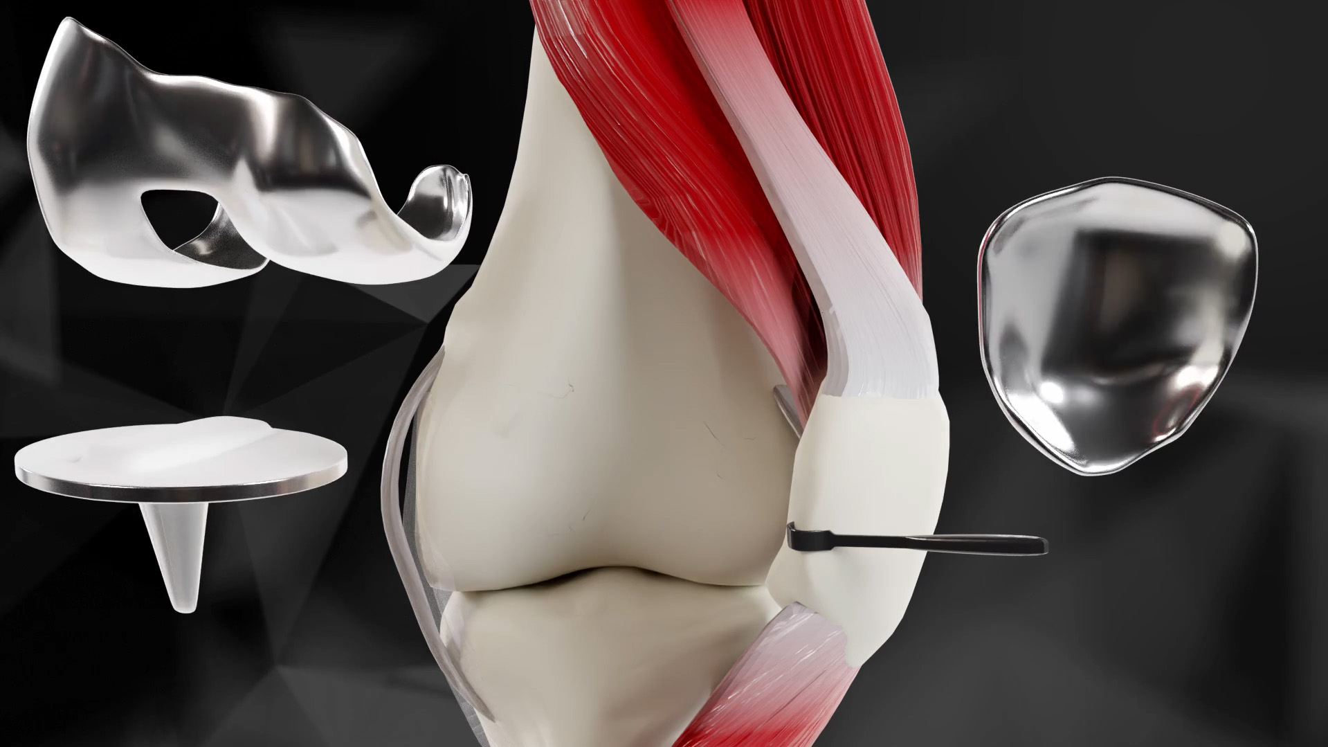 Jiffy Knee