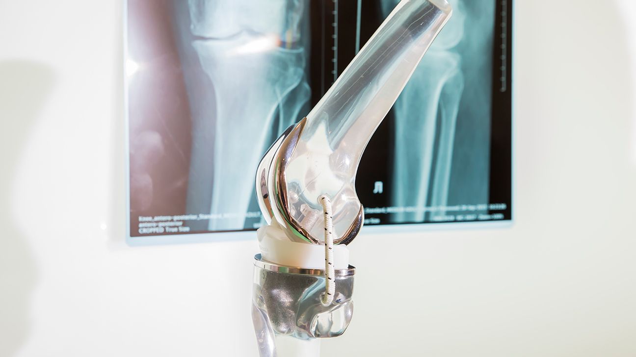 Knee Conditions and Treatment Options