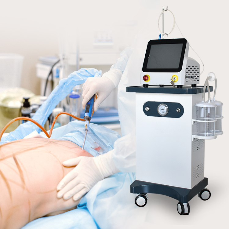 Liposuction Machine industry insight