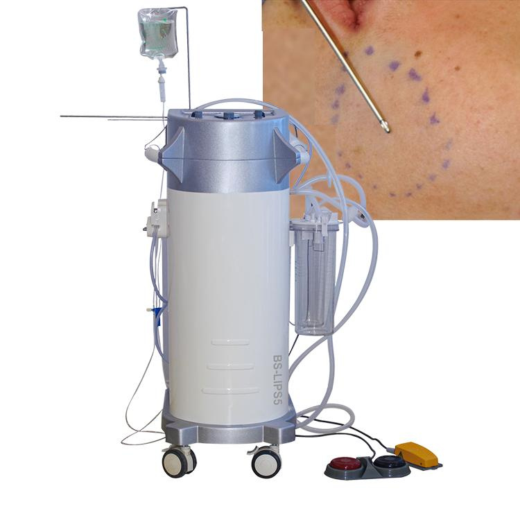 Liposuction Machine industry insight