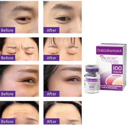 botox manufacturer