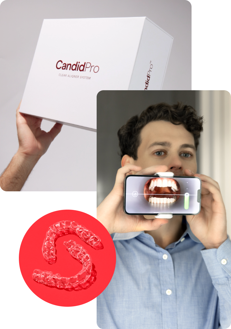 candid pro aligners manufacturer