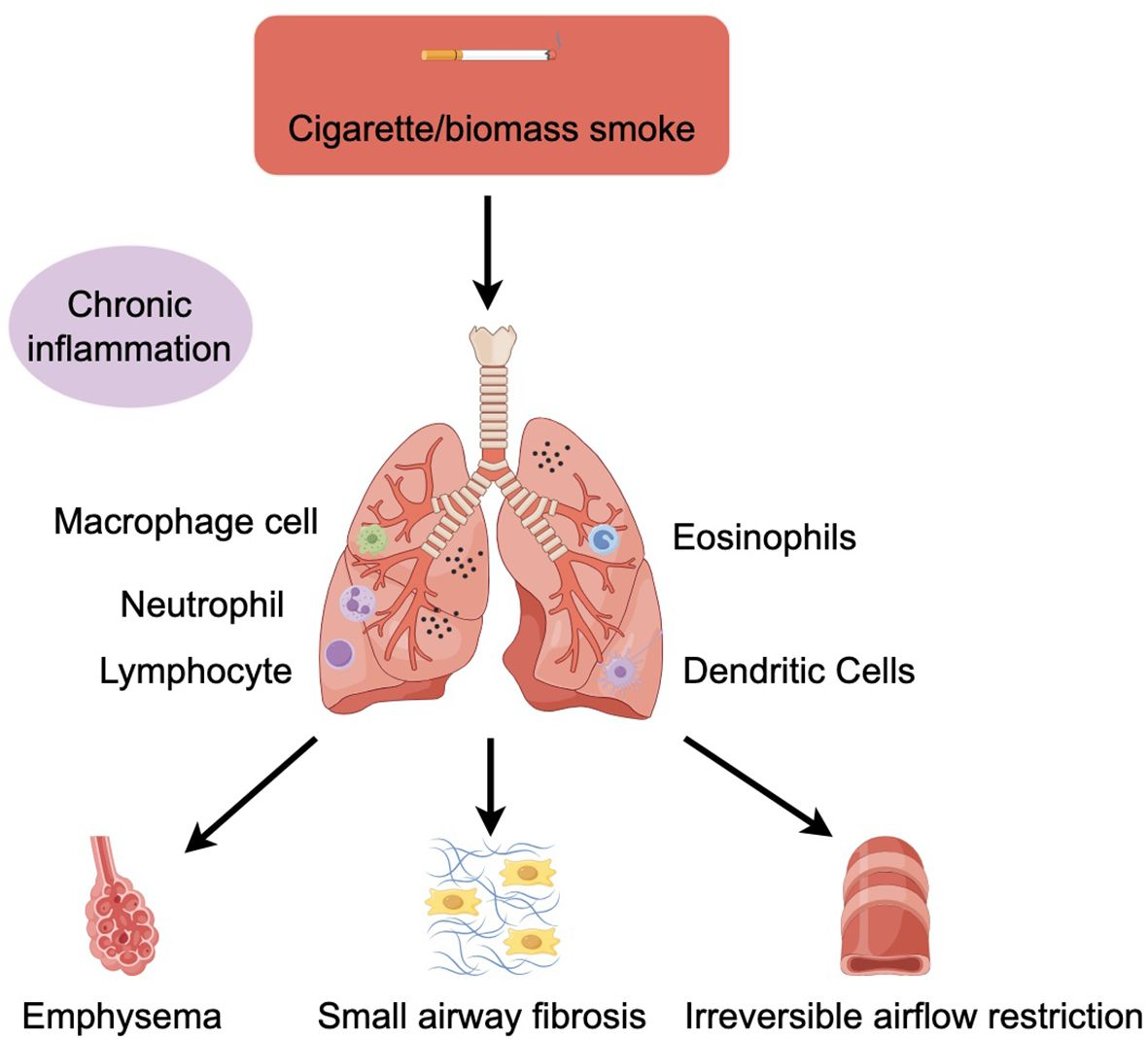 Study to investigate changes in airway inflammation, symptoms, and ...